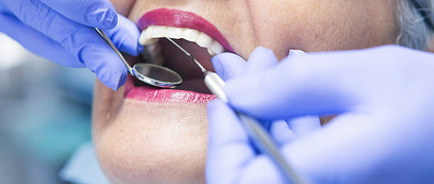 Best Emergency Gum Treatment in Beattyville, KY